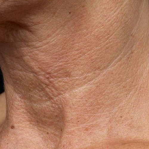 Especialistas descobrem método natural para melhorar a visão em apenas 14 dias